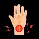 "Illustration showing carpal tunnel syndrome during pregnancy, where increased fluid retention and hormonal changes cause pressure on the median nerve in the wrist