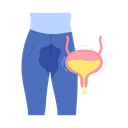 Urinary incontinence: