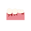 Bleeding and or swollen gums