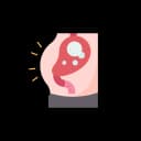 "Illustration of stomach bloating with digestive tract, showing abdominal distension and gas buildup — concept of indigestion, gut health, or gastrointestinal discomfort"